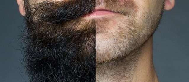 La Vérité sur l'Accélération de la Pousse de la Barbe